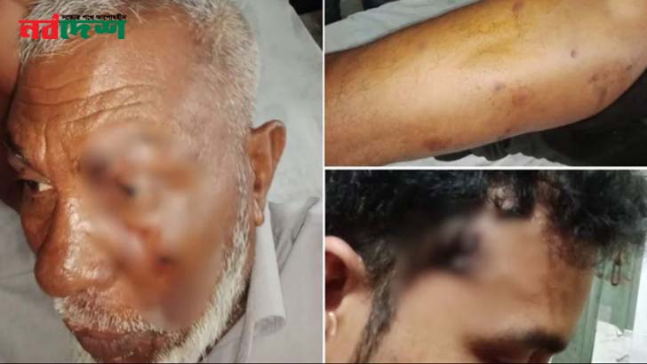 পদ্মায় টহলরত পুলিশের ওপর সন্ত্রাসী হামলা, ওসিসহ ৫ সদস্য গুলিবিদ্ধ